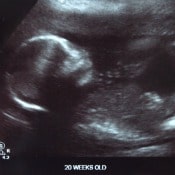 Thumbnail image for It’s Official!